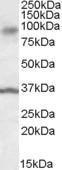 Anti-ANKK1 antibody