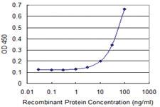 Anti-SNX24 Mouse Monoclonal Antibody [clone: 2A11]