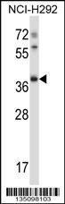 Anti-TSSK6 Rabbit Polyclonal Antibody