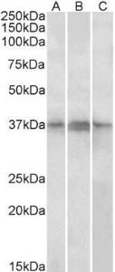 Anti-PHF11 antibody