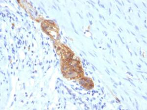 Immunohistochemical analysis of formalin-fixed, paraffin-embedded human colon using Anti-NCAM1 Antibody [SPM489]