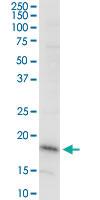 Anti-DAZAP2 Mouse Monoclonal Antibody [clone: 8G5]