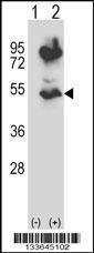 Anti-HTRA2 Rabbit Polyclonal Antibody