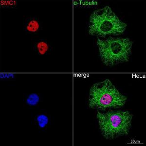 Confocal imaging of HeLa cells using Anti-SMC1A Antibody [ARC1095] (A308993), at a dilution of 1:100, (red). The cells were counterstained with Anti-alpha Tubulin Antibody, at a dilution of 1:400, (green). DAPI was used for nuclear staining (Blue). Objective: 60x