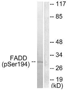 Western blot analysis of lysates from HeLa cells treated with Paclitaxel 1uM 60' using Anti-FADD (phospho Ser194) Antibody The right hand lane represents a negative control, where the antibody is blocked by the immunising peptide