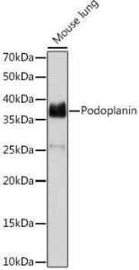 Western blot analysis of extracts of Mouse lung, using Anti-Podoplanin/gp36 Antibody [ARC1488] (A306073) at 1:1000 dilution. The secondary Antibody was Goat Anti-Rabbit IgG H&L Antibody (HRP) at 1:10000 dilution. Lysates/proteins were present at 25 µg per lane