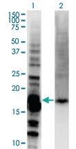 Anti-DAZAP2 Mouse Monoclonal Antibody [clone: 8G5]