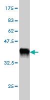 Anti-GABPA Mouse Monoclonal Antibody [clone: 1D6]