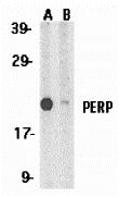 Western blot analysis of PERP expression in A431 whole cell lysates in the absence (A) and presence (B) of blocking peptide (2451P) with PERP antibody at 1 &#956;g /ml.