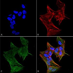 Immunocytochemistry/Immunofluorescence analysis of human neuroblastoma cell line (SK-N-BE, fixed in 4% formaldehyde for 15 min at room temperature, using Anti-IFT88 Antibody (A304920), at 1:100 for 60 minutes at room temperature