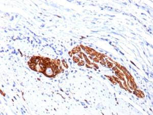 Immunohistochemical analysis of formalin-fixed, paraffin-embedded human colon ganglion using Anti-NCAM1 Antibody [123C3.D5 + 123A8]