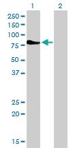 Anti-DMPK Mouse Monoclonal Antibody [clone: 2F7]