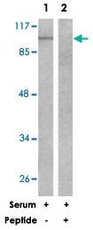 Anti-EEF2K Rabbit Polyclonal Antibody