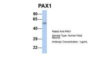 Anti-PAX1 Rabbit Polyclonal Antibody