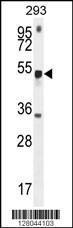 Anti-METTL4 Rabbit Polyclonal Antibody