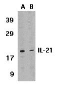 Western blot analysis of IL-21 expression in HL-60 cell lysate in the absence (lane A) or presence of blocking peptide (2465P) (lane B) with IL-21 antibody at 1 &#956;g /ml.