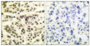 Anti-MAPKAPK2/3 Rabbit Polyclonal Antibody