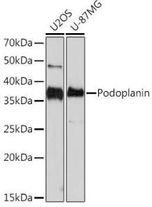 Western blot analysis of extracts of various cell lines, using Anti-Podoplanin/gp36 Antibody [ARC1488] (A306073) at 1:1000 dilution. The secondary Antibody was Goat Anti-Rabbit IgG H&L Antibody (HRP) at 1:10000 dilution. Lysates/proteins were present at 25 µg per lane