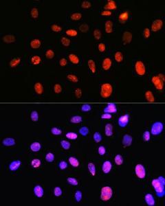 Immunofluorescence analysis of C6 cells using Anti-Topoisomerase I Antibody [ARC0708] (A307759) at a dilution of 1:100 (40X lens). DAPI was used to stain the cell nuclei (blue)