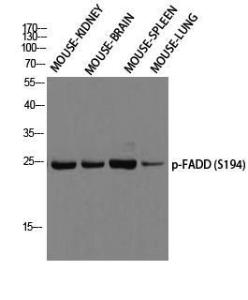 Western blot analysis of mouse kidney, mouse brain, mouse spleen, mouse lung using Anti-FADD (phospho Ser194) Antibody