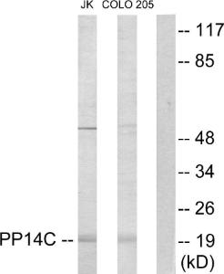 Anti-PPP1R14C antibody