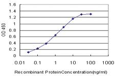 Anti-DMPK Mouse Monoclonal Antibody [clone: 2F7]