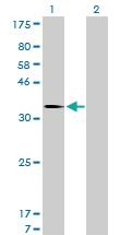 Anti-MDM2 Mouse Monoclonal Antibody [clone: 1A7]