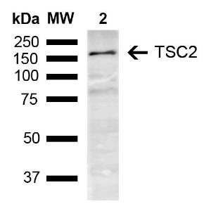 Western blot analysis of mouse brain showing detection of ~200.6 kDa TSC2 protein using Anti-Tuberin Antibody (A304921) at 1:1000 for 2 hours at room temperature. Lane 1: Molecular Weight Ladder (MW). Lane 2: mouse Brain.