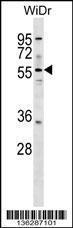 Anti-ASNS Rabbit Polyclonal Antibody (FITC (Fluorescein Isothiocyanate))