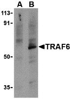 Western blot analysis of TRAF6 in PC-3 cell lysates with TRAF6 antibody at 1 &#956;g/ml in the presence (A) or absence (B) of 1 &#956;g blocking peptide (3129P).