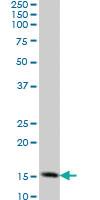 Anti-TOMM20 Mouse Monoclonal Antibody [clone: 4F3]