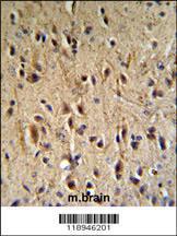 Anti-PTHLH Rabbit Polyclonal Antibody (APC (Allophycocyanin))