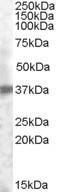 Antibody anti-TACSTD2 100 µg