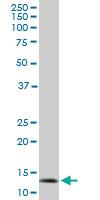 Anti-TOMM20 Mouse Monoclonal Antibody [clone: 4F3]