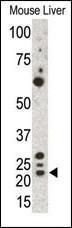 Anti-GREM1 Rabbit Polyclonal Antibody (AP (Alkaline Phosphatase))