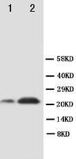 Anti-SOCS2 Rabbit Polyclonal Antibody