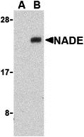 Western blot analysis of NADE in Human brain cell lysates with NADE antibody at 1 &#956;g/mL in the presence (A) or absence (B) of blocking peptide (3359P).