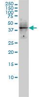 Anti-DMRT1 Mouse Monoclonal Antibody [clone: 1G11]