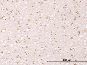 Anti-MDM2 Mouse Monoclonal Antibody [clone: 1A7]