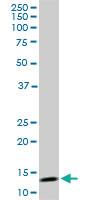 Anti-TOMM20 Mouse Monoclonal Antibody [clone: 4F3]