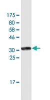 Anti-DAZAP2 Mouse Monoclonal Antibody [clone: 3G21]