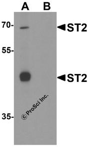 Western blot analysis of ST2 in 293 cell lysate with ST2 antibody at 1 &#956;g/ml in (A) the absence and (B) the presence of blocking peptide.