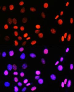 Immunofluorescence analysis of NIH-3T3 cells using Anti-Topoisomerase I Antibody [ARC0708] (A307759) at a dilution of 1:100 (40X lens). DAPI was used to stain the cell nuclei (blue)