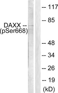 Western blot analysis of lysates from 293 cells treated with PBS 60' using Anti-Daxx (phospho Ser668) Antibody. The right hand lane represents a negative control, where the antibody is blocked by the immunising peptide