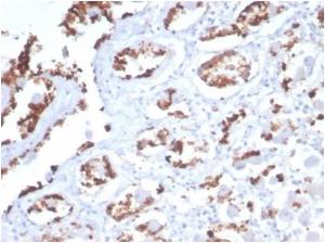 Immunohistochemical analysis of formalin-fixed, paraffin-embedded human stomach tissue using Anti-Mucin 5AC Antibody [MUC5AC/7068R]