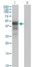 Anti-DMRT1 Mouse Monoclonal Antibody [clone: 1G11]