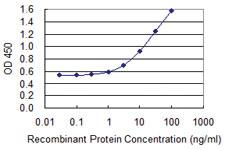 Anti-SERPINA3 Mouse Monoclonal Antibody [clone: 3F5]