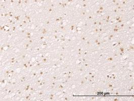 Anti-MDM2 Mouse Monoclonal Antibody [clone: 1A7]