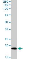 Anti-BAALC Goat Polyclonal Antibody