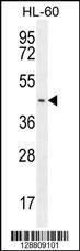 Anti-GPR142 Rabbit Polyclonal Antibody (APC (Allophycocyanin))